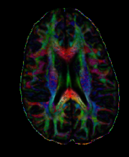 brain