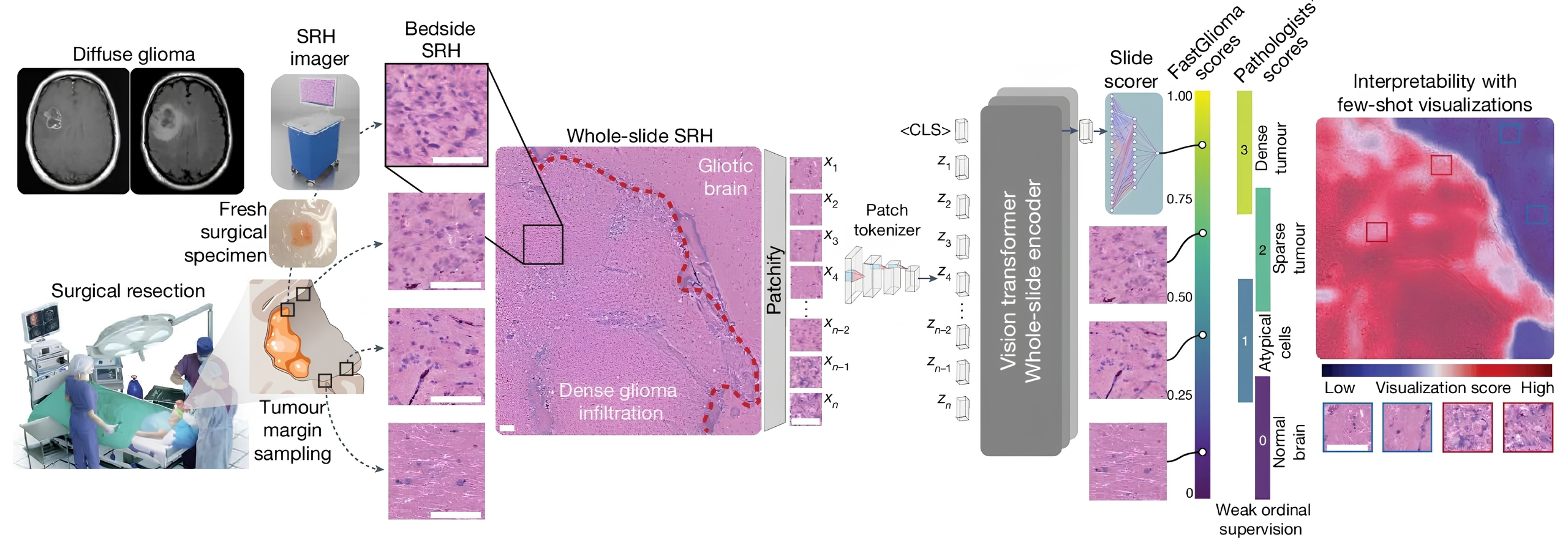 Two-panel scientific figure. Panel A shows a “Retrosplenial Model Neuron” receiving inputs from many thalamic head-direction cells with different preferred head directions. Green “depressing HD input” and orange “non-depressing HD input” arrows point to a purple neuron diagram. Panel B shows a line graph of firing-rate/head-speed correlation versus time lag; the green depressing-synapse curve is much higher and peaks at negative time lag, indicating encoding of past head speed, while the orange non-depressing-synapse curve remains low across time lags.